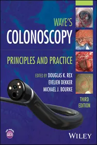 Colonoscopy_cover