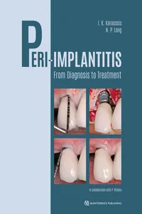 Peri-Implantitis_cover