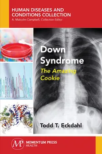 Down Syndrome_cover