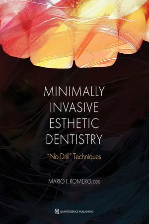 Minimally Invasive Esthetic Dentistry