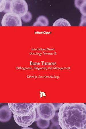 Bone Tumors