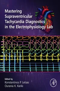 Mastering Supraventricular Tachycardia Diagnostics in the Electrophysiology Lab_cover