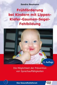 Frühförderung bei Kindern mit Lippen-Kiefer-Gaumen-Segel-Fehlbildung_cover