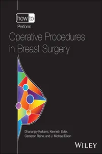 How to Perform Operative Procedures in Breast Surgery