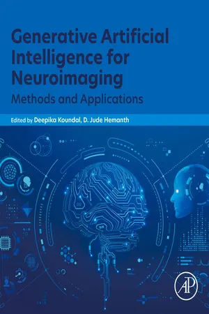 Generative Artificial Intelligence for Neuroimaging
