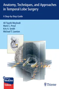 Anatomy, Techniques, and Approaches in Temporal Lobe Surgery