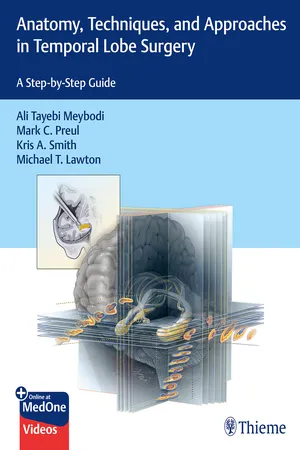 Anatomy, Techniques, and Approaches in Temporal Lobe Surgery