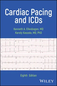 Cardiac Pacing and ICDs_cover