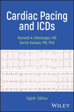 Cardiac Pacing and ICDs