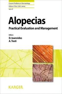 Alopecias - Practical Evaluation and Management_cover
