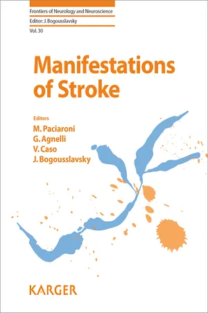 Manifestations of Stroke