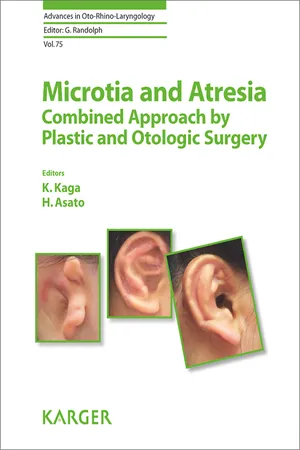 Microtia and Atresia - Combined Approach by Plastic and Otologic Surgery