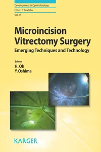 Microincision Vitrectomy Surgery_cover