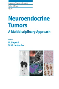 Neuroendocrine Tumors: A Multidisciplinary Approach_cover