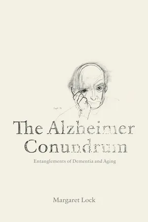 The Alzheimer Conundrum