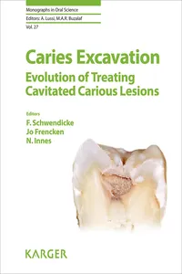 Caries Excavation: Evolution of Treating Cavitated Carious Lesions_cover