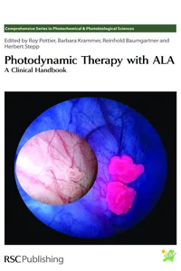 Photodynamic Therapy with ALA_cover