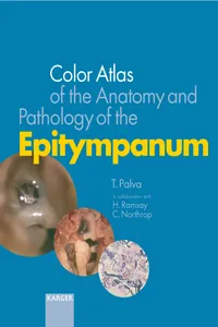 Color Atlas of the Anatomy and Pathology of the Epitympanum_cover