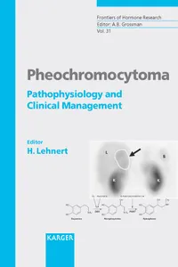 Pheochromocytoma_cover
