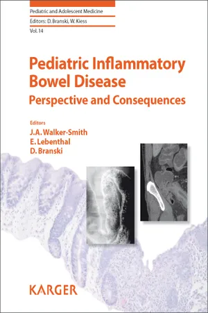 Pediatric Inflammatory Bowel Disease