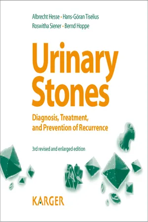 Urinary Stones