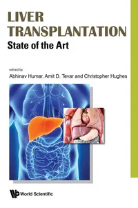 Liver Transplantation_cover