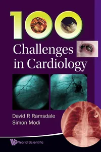 100 Challenges in Cardiology_cover