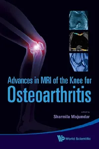 Advances In Mri Of The Knee For Osteoarthritis_cover