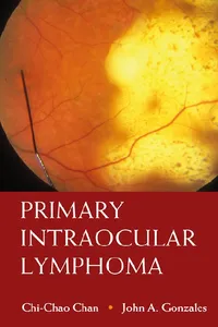 Primary Intraocular Lymphoma_cover