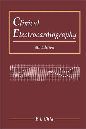 Clinical Electrocardiography