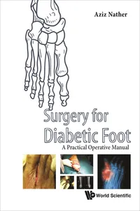 Surgery for Diabetic Foot_cover