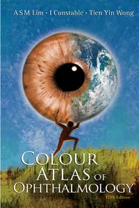 Colour Atlas of Ophthalmology_cover