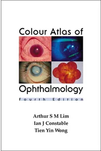 Colour Atlas of Ophthalmology_cover