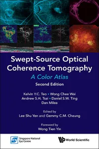 Swept-Source Optical Coherence Tomography_cover