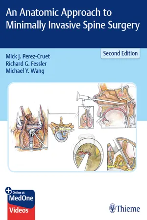 An Anatomic Approach to Minimally Invasive Spine Surgery