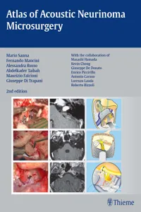 Atlas of Acoustic Neurinoma Microsurgery_cover