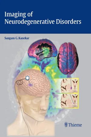 Imaging of Neurodegenerative Disorders