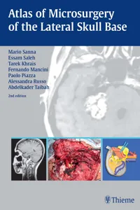 Atlas of Microsurgery of the Lateral Skull Base_cover