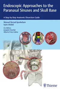 Endoscopic Approaches to the Paranasal Sinuses and Skull Base_cover