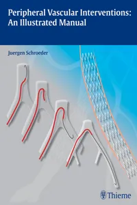 Peripheral Vascular Interventions: An Illustrated Manual_cover