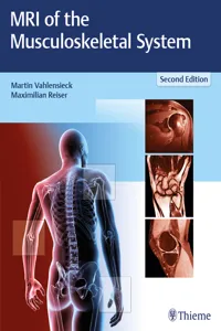 MRI of the Musculoskeletal System_cover