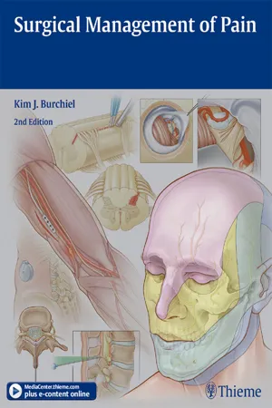 Surgical Management of Pain