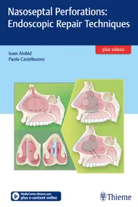 Nasoseptal Perforations: Endoscopic Repair Techniques_cover