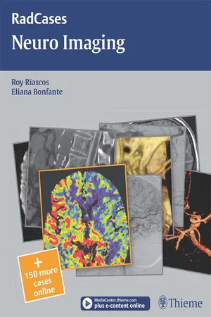 Neuro Imaging