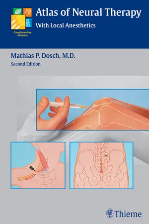 Atlas of Neural Therapy With Local Anesthetics