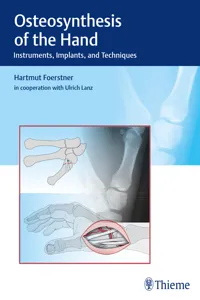 Osteosynthesis of the Hand_cover