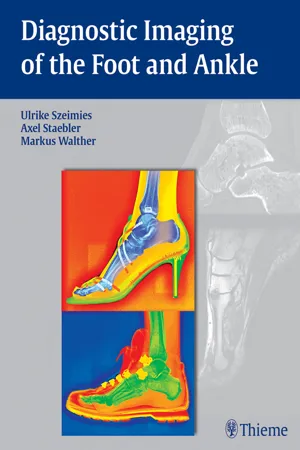 Diagnostic Imaging of the Foot and Ankle