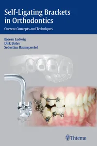 Self-Ligating Brackets in Orthodontics_cover