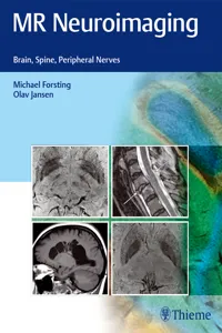 MR Neuroimaging_cover