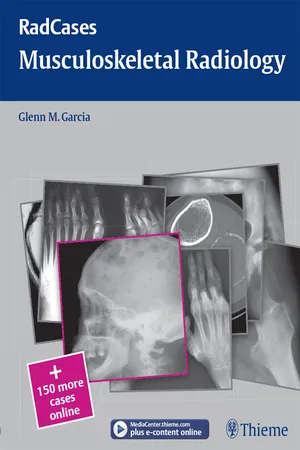 Musculoskeletal Radiology